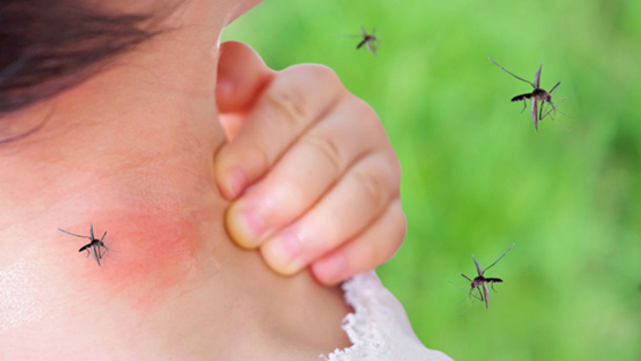 बच्चों को Mosquito Cream लगानी चाहिए या नहीं? डॉक्टर ने बताया क्या है मच्छर से बचाने का सबसे सेफ तरीका