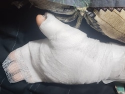 Mumbai Teacher Burns 8-Year-Old&#039;s Hand With Candle Over Bad Handwriting