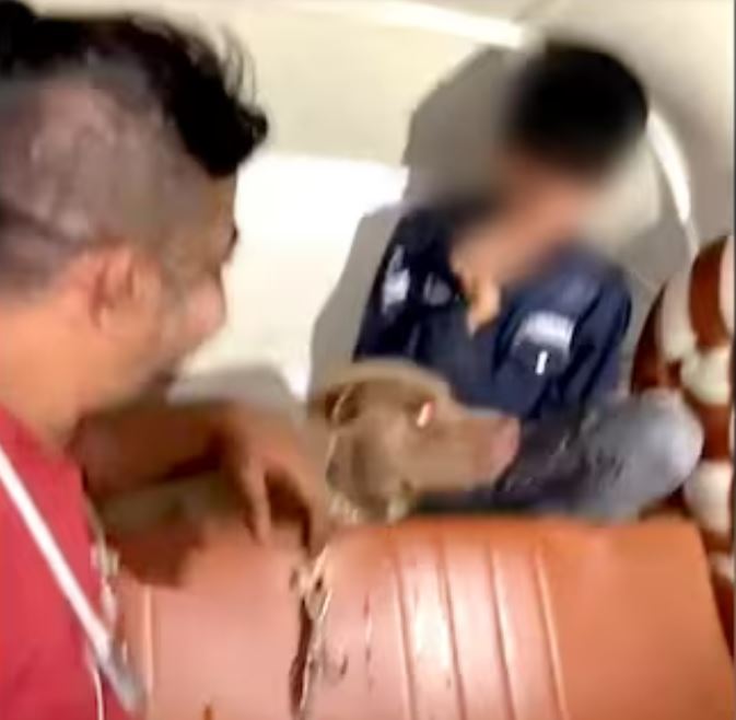 हंसता रहा मालिक, काटता रहा पिटबुल, 11 साल के बच्चे पर हुआ दिल दहला देने वाला हमला