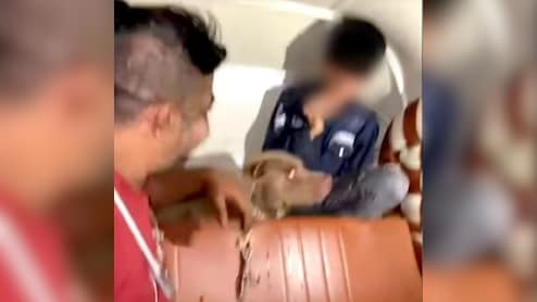 हंसता रहा मालिक, काटता रहा पिटबुल, 11 साल के बच्चे पर हुआ दिल दहला देने वाला हमला