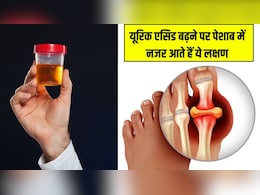 Uric Acid बढ़ने पर पेशाब में नजर आते हैं ये लक्षण, डॉ. ने बताया ये खाने से बाहर आ जाएंगे सारे टॉक्सिन