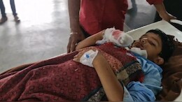 Mobile Blast: मोबाइल की बैटरी अचानक फट गई, मासूम की उंगलियां उड़ी, हालत गंभीर