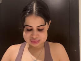 बुरी तरह फूला चेहरा, सूजे गए होंठ, उर्फी जावेद के नए वीडियो ने किया हैरान, पहचानना मुश्किल बुरी तरह फूला चेहरा, सूजे गए होंठ, उर्फी जावेद के नए वीडियो ने किया हैरान, पहचानना मुश्किल