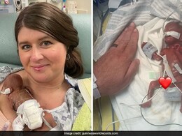 Miracle baby: जन्मतःच गिनीज वर्ल्ड रेकॉर्डमध्ये नाव, अवघ्या 21 आठवड्यांत झाला बाळाचा जन्म