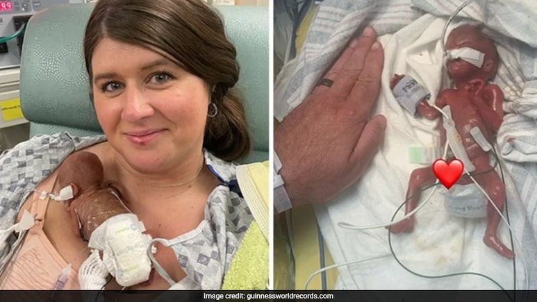 Miracle baby: जन्मतःच गिनीज वर्ल्ड रेकॉर्डमध्ये नाव, अवघ्या 21 आठवड्यांत झाला बाळाचा जन्म Miracle baby: जन्मतःच गिनीज वर्ल्ड रेकॉर्डमध्ये नाव, अवघ्या 21 आठवड्यांत झाला बाळाचा जन्म