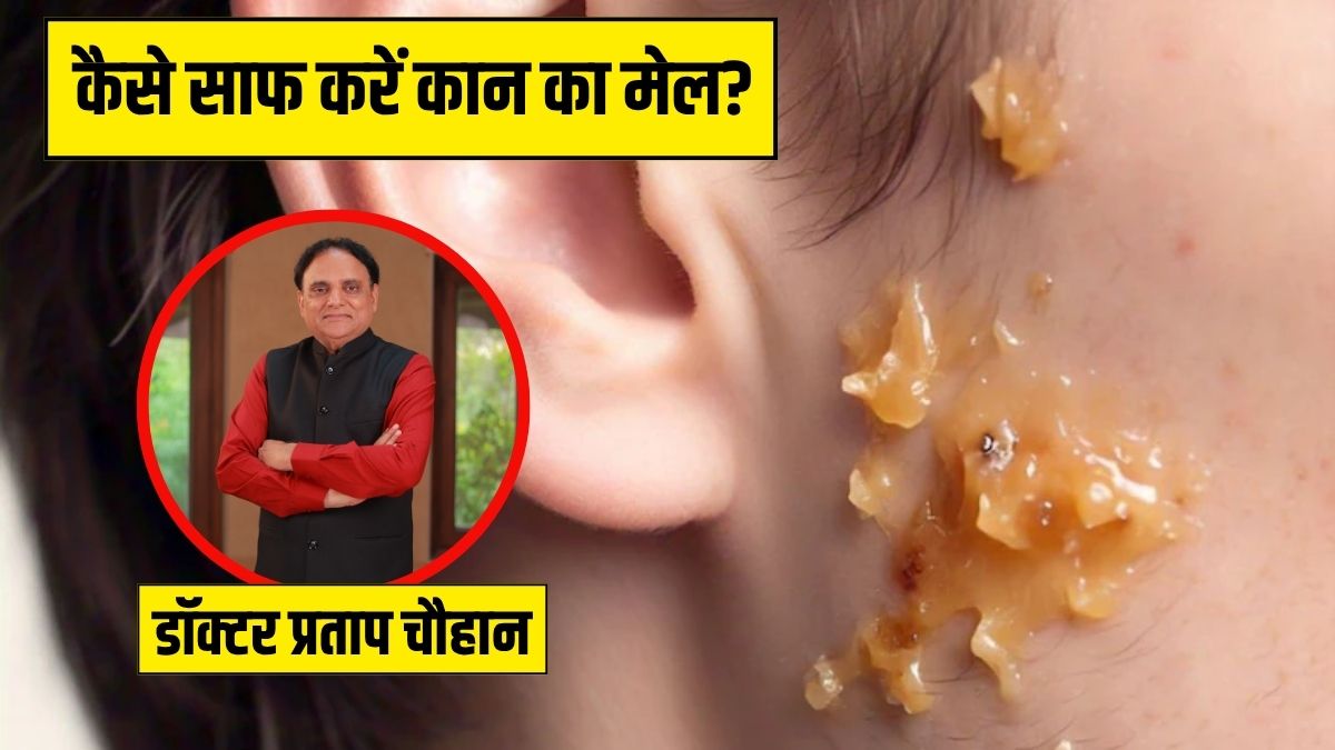 कान में जम गया है मैल? आयुर्वेदिक डॉक्टर ने बताया इस तेल की 2 बूंद डाल दें, सुबह तक सारी गंदगी आ जाएगी बाहर