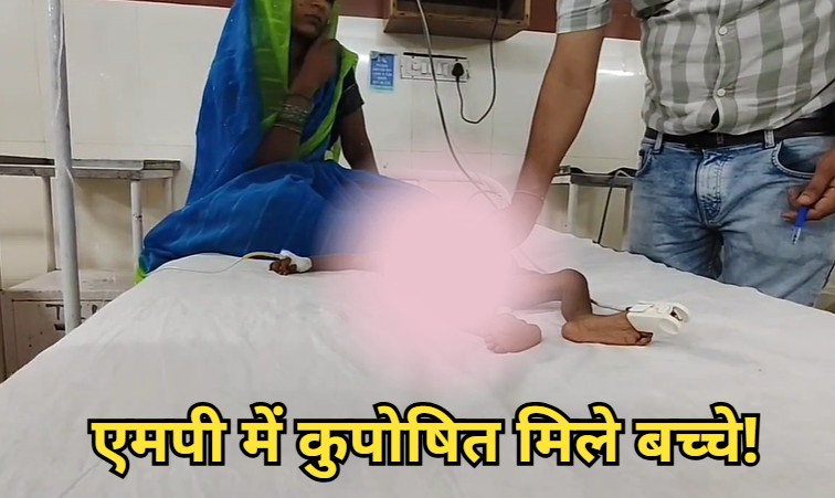 भिंड में कुषोपित मिले एक ही परिवार के 3 मासूम, एक ने तोड़ा दम, आनन-फानन में ग्वालियर रेफर किए गए दो बच्चे