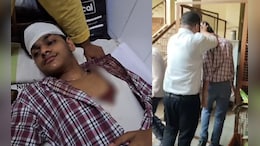 शिक्षक का डंडे से हमला, छात्र का सिर फटा तो बहने लगी खून की धार; आए 5 टांके