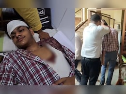 शिक्षक का डंडे से हमला, छात्र का सिर फटा तो बहने लगी खून की धार; आए 5 टांके शिक्षक का डंडे से हमला, छात्र का सिर फटा तो बहने लगी खून की धार; आए 5 टांके