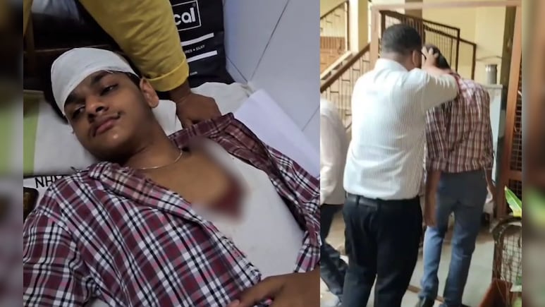 शिक्षक का डंडे से हमला, छात्र का सिर फटा तो बहने लगी खून की धार; आए 5 टांके शिक्षक का डंडे से हमला, छात्र का सिर फटा तो बहने लगी खून की धार; आए 5 टांके
