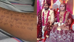 UP Woman's Detailed Suicide Note On Arm, Leg, Stomach Over Dowry Harassment