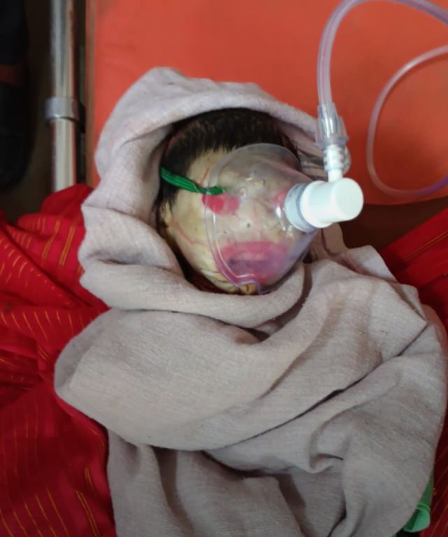 रीवा में जन्मे इस बच्चे को क्यों कहा जा रहा 'एलियन बेबी'? देख डॉक्टर भी रह गए हैरान