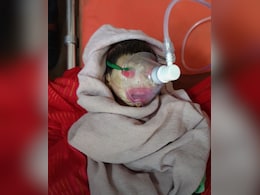 रीवा में जन्मे इस बच्चे को क्यों कहा जा रहा 'एलियन बेबी'? देख डॉक्टर भी रह गए हैरान