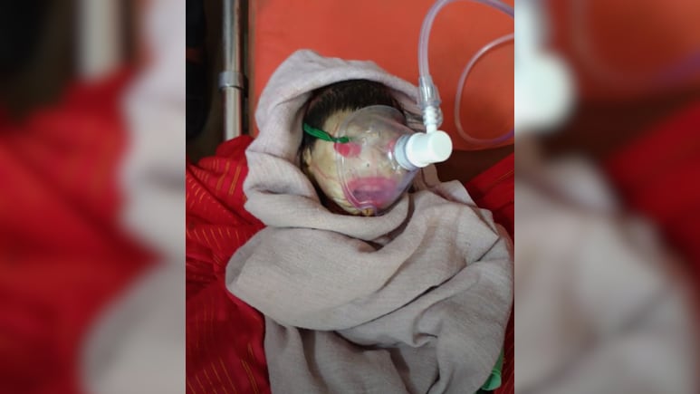 रीवा में जन्मे इस बच्चे को क्यों कहा जा रहा 'एलियन बेबी'? देख डॉक्टर भी रह गए हैरान रीवा में जन्मे इस बच्चे को क्यों कहा जा रहा 'एलियन बेबी'? देख डॉक्टर भी रह गए हैरान