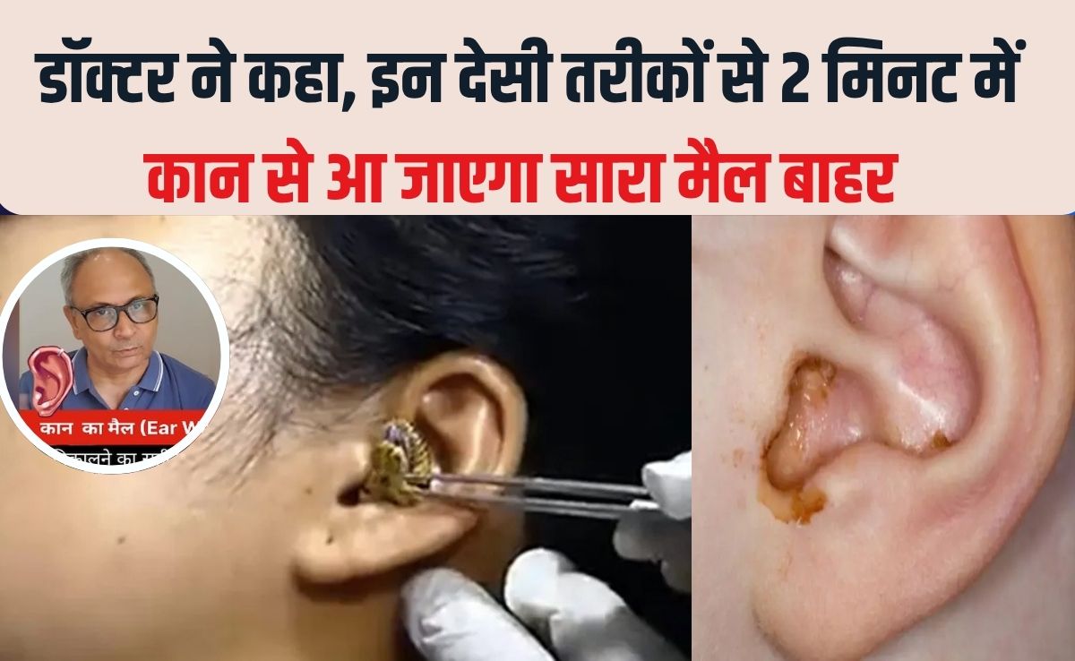 2 म‍िनट में कान का मैल आ जाएगा बाहर, सरसों के तेल में बस यह सफेद चीज म‍िलाकर डालें