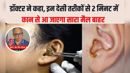 2 म‍िनट में कान का मैल आ जाएगा बाहर, सरसों के तेल में बस यह सफेद चीज म‍िलाकर डालें