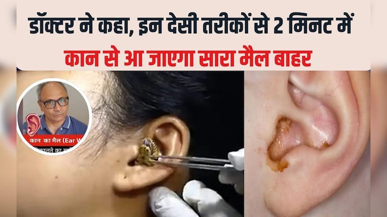2 म‍िनट में कान का मैल आ जाएगा बाहर, सरसों के तेल में बस यह सफेद चीज म‍िलाकर डालें