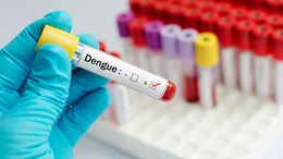 Dengue Fever: More Than 45,000 Cases Reported In India; How To Stay Safe