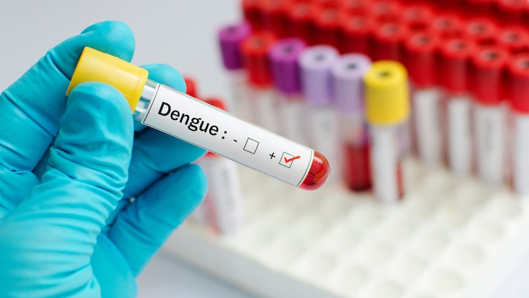 Dengue Fever: More Than 45,000 Cases Reported In India; How To Stay Safe