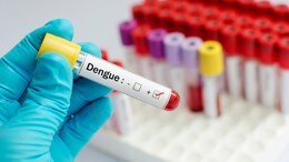 Dengue Effects on brain : डेंग्यूचा मेंदूलाही धोका; दुर्लक्ष करणं पडू शकतं महागात!
