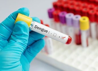 West Bengal Launches Intensive Dengue Testing Campaign Amid Rising Cases