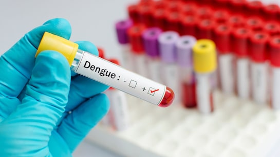 मुंबई में डेंगू मामलों में रिकॉर्ड बढ़ोतरी, डेंगू के चलते अब तक 2 बच्चों की  मौत! | Record increase in dengue cases in Mumbai, 2 children dead so far  due to dengue!