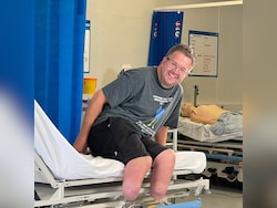 UK Surgeon Chopped Off His Legs To Claim Rs 5.4 Crore In Insurance Payout