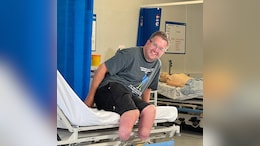 UK Doctor, Who Chopped Off His Legs, Jailed For Fraud, Saving Amputation Porn
