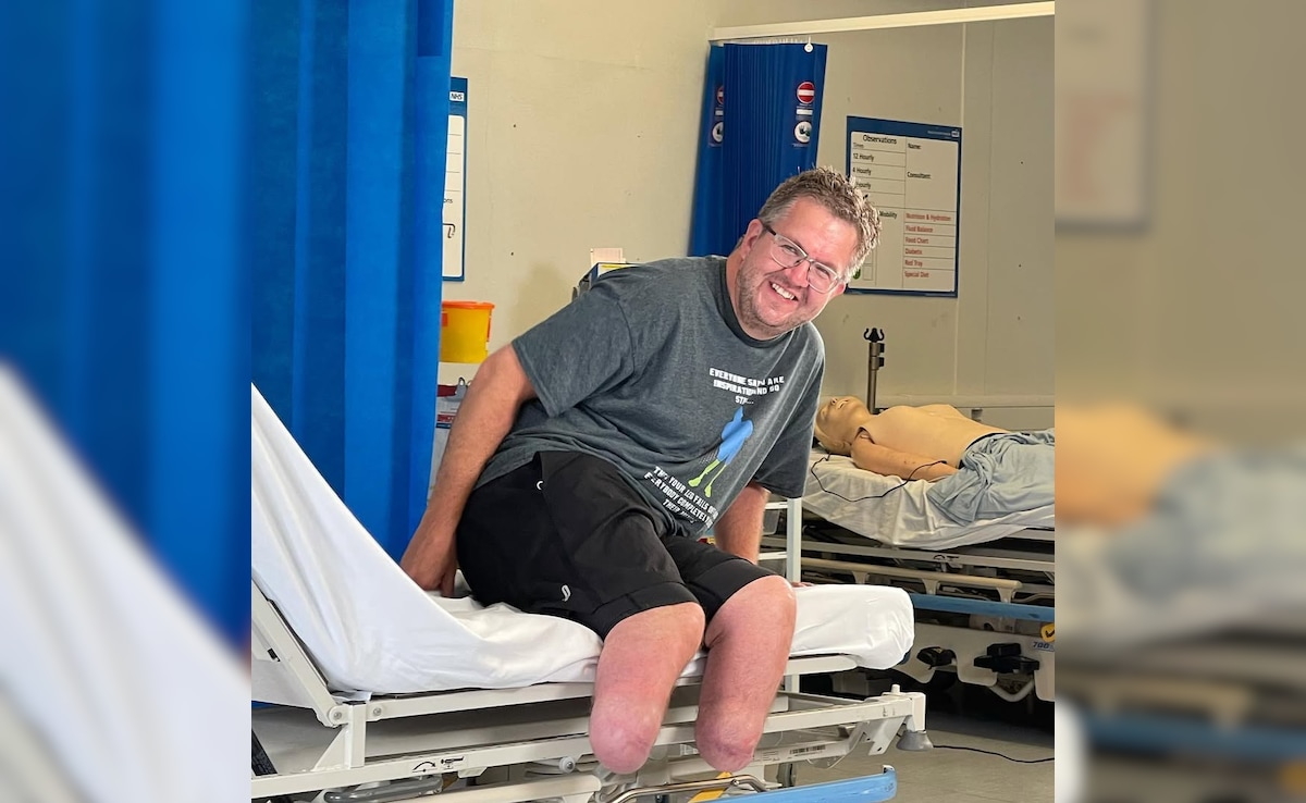 UK Surgeon Chopped Off His Legs To Claim Rs 5.4 Crore In Insurance Payout