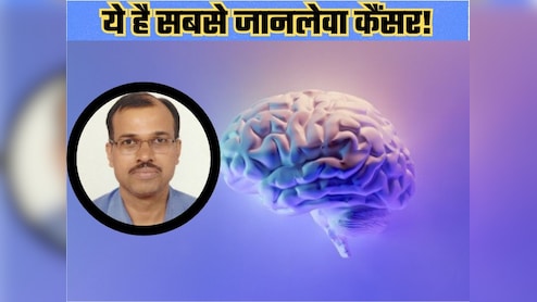 Dr. Ajay Chaudhary ने बताया कौन सा कैंसर है सबसे खतरनाक, सिर्फ डेढ़ से 2 साल तक ही जी पाता है मरीज
