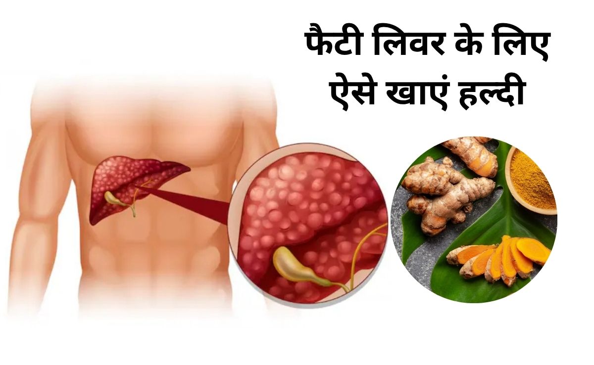 Fatty Liver से बचना है तो ऐसे खाएं हल्दी, आयुर्वेदिक एक्सपर्ट ने बताया जबरदस्त नुस्खा