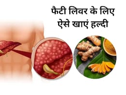 Fatty Liver से बचना है तो ऐसे खाएं हल्दी, आयुर्वेदिक एक्सपर्ट ने बताया जबरदस्त नुस्खा Fatty Liver से बचना है तो ऐसे खाएं हल्दी, आयुर्वेदिक एक्सपर्ट ने बताया जबरदस्त नुस्खा