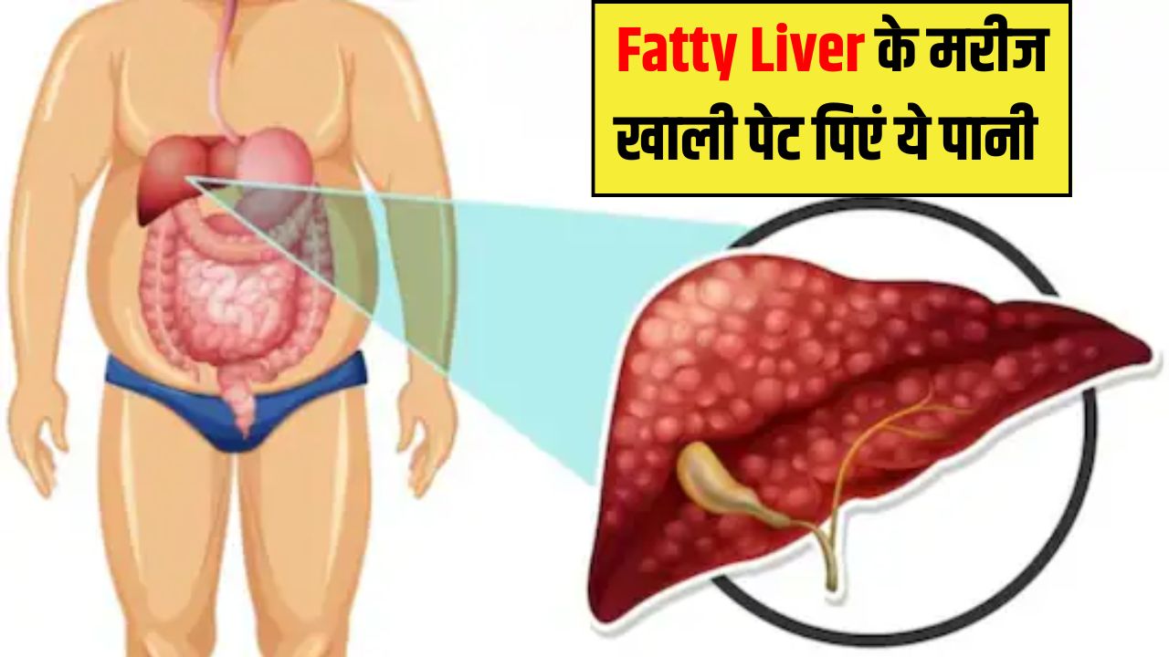 Fatty Liver के मरीज खाली पेट पीना शुरू कर दें ये पानी, न्यूट्रिशनिस्ट ने बताया खुद रिपेयर होने लगेगा जिगर