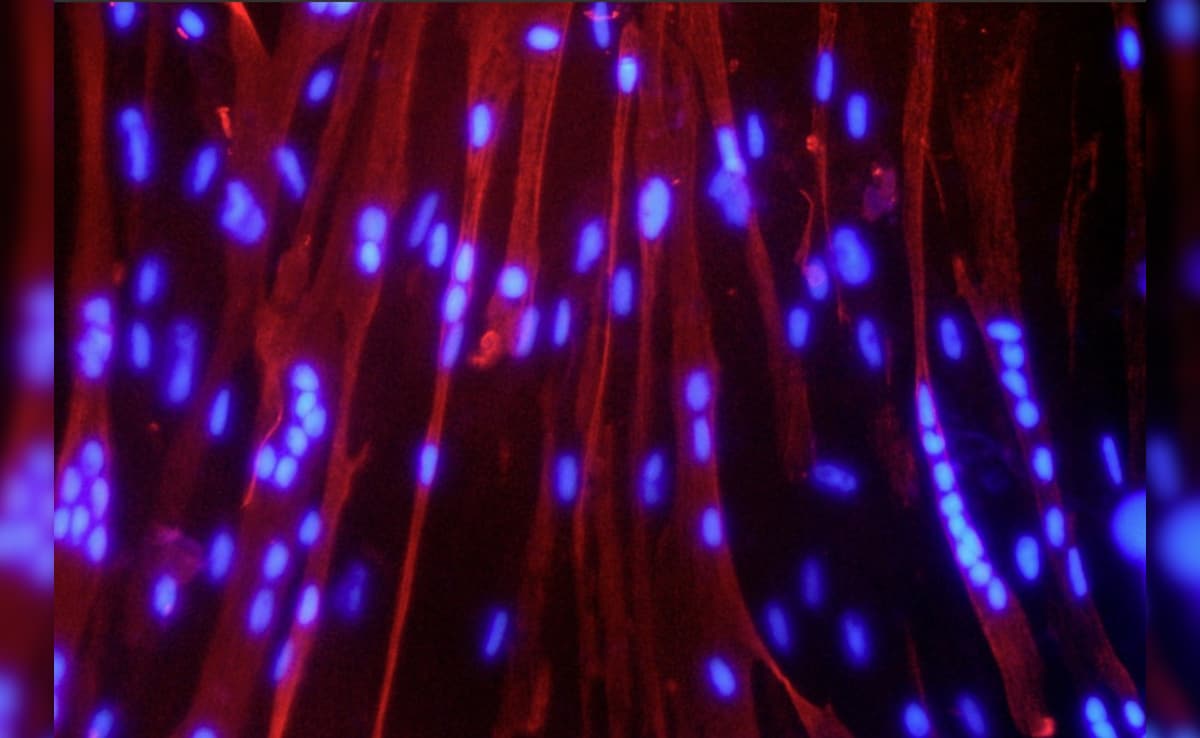 Latest and Breaking News on NDTV Latest and Breaking News on NDTV