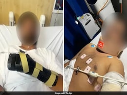 "Hand Was Hanging By Thread": Indian-Origin Man Attacked In Australia "Hand Was Hanging By Thread": Indian-Origin Man Attacked In Australia