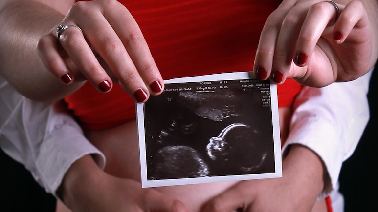 Can Artificial Intelligence Improve IVF Success Rates? Fertility Expert Weighs In