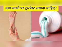 क्या जलने पर टूथपेस्ट लगाना चाहिए? डॉक्टर ने बताया अगर जल जाए, तो सबसे पहले घर पर क्या करें क्या जलने पर टूथपेस्ट लगाना चाहिए? डॉक्टर ने बताया अगर जल जाए, तो सबसे पहले घर पर क्या करें