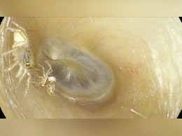 महिला ने सुनी अजीबोगरीब आवाजें, डॉक्टर के पास गईं तो, कान में मिली ऐसी चीज, डॉक्टर भी रह गए हैरान महिला ने सुनी अजीबोगरीब आवाजें, डॉक्टर के पास गईं तो, कान में मिली ऐसी चीज, डॉक्टर भी रह गए हैरान