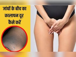 जांघों के कालापन के ये हैं लक्षण, डॉक्टर ने बताया इस तरह से दूर कर सकते हैं थाइज की डार्कनेस जांघों के कालापन के ये हैं लक्षण, डॉक्टर ने बताया इस तरह से दूर कर सकते हैं थाइज की डार्कनेस