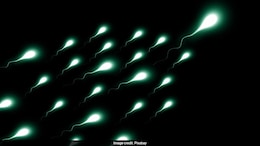 Think Your Sperm Is Healthy? Nutritionist Shares Sperm Health Factors That Standard Tests Often Miss