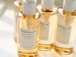 "The Viral Madagascar Centella Cleansing Oil Burnt My Face, Gave Me Boils": 29-Year-Old Writer To NDTV "The Viral Madagascar Centella Cleansing Oil Burnt My Face, Gave Me Boils": 29-Year-Old Writer To NDTV