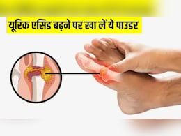 पेशाब के साथ निकल जाएगा बढ़ा हुआ यूरिक एसिड, बस पानी में मिलाकर पी लें ये पाउडर, आयुर्वेदिक डॉ ने बताया नुस्खा पेशाब के साथ निकल जाएगा बढ़ा हुआ यूरिक एसिड, बस पानी में मिलाकर पी लें ये पाउडर, आयुर्वेदिक डॉ ने बताया नुस्खा