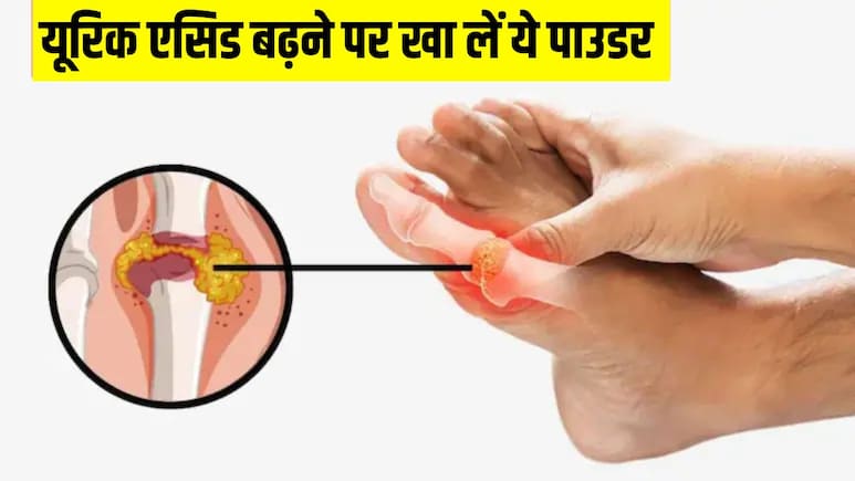 पेशाब के साथ निकल जाएगा बढ़ा हुआ यूरिक एसिड, बस पानी में मिलाकर पी लें ये पाउडर, आयुर्वेदिक डॉ ने बताया नुस्खा पेशाब के साथ निकल जाएगा बढ़ा हुआ यूरिक एसिड, बस पानी में मिलाकर पी लें ये पाउडर, आयुर्वेदिक डॉ ने बताया नुस्खा