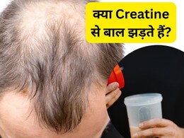 क्रिएटिन लेने पर क्या झड़ने लगते हैं बाल? Creatine लेने वाले पुरुषों को जरूर सुननी चाहिए डॉक्टर की यह बात क्रिएटिन लेने पर क्या झड़ने लगते हैं बाल? Creatine लेने वाले पुरुषों को जरूर सुननी चाहिए डॉक्टर की यह बात