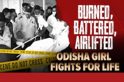 Burned, Battered, Airlifted: Odisha Girl Fights For Life Burned, Battered, Airlifted: Odisha Girl Fights For Life