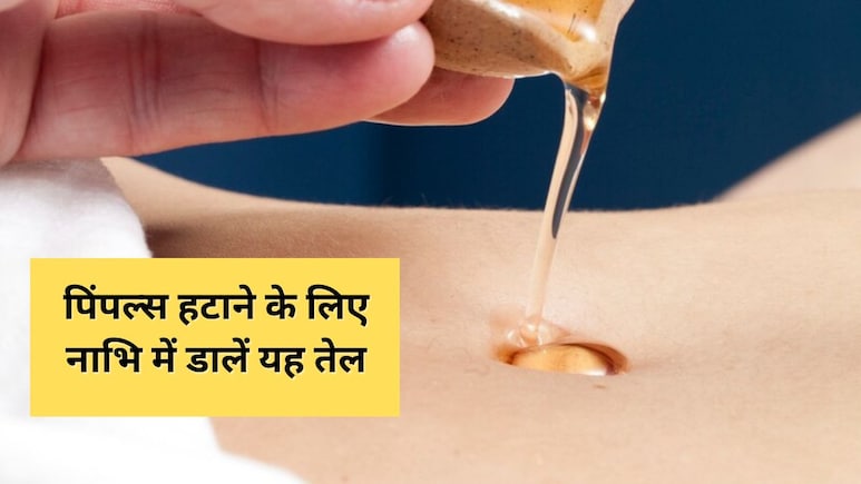 स्किन एक्सपर्ट ने बताया शरीर पर बहुत दाने हैं तो नाभि में डालें यह तेल, पिंपल्स से मिल जाएगा छुटकारा स्किन एक्सपर्ट ने बताया शरीर पर बहुत दाने हैं तो नाभि में डालें यह तेल, पिंपल्स से मिल जाएगा छुटकारा