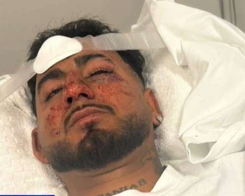 "F*** Off, Indian": Man Brutally Assaulted, Racially Abused In Australia