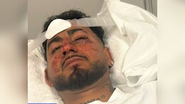 "F*** Off, Indian": Man Brutally Assaulted, Racially Abused In Australia