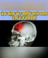 Brain Stroke से एक महीने पहले हमारा शरीर देता है ये चेतावनी, एक्सपर्ट ने बताया कैसे करें बचाव