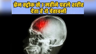 Brain Stroke से एक महीने पहले हमारा शरीर देता है ये चेतावनी, एक्सपर्ट ने बताया कैसे करें बचाव
